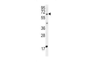 Western Blotting (WB) image for anti-Makorin Ring Finger Protein 3 (MKRN3) (AA 160-189) antibody (ABIN651835)
