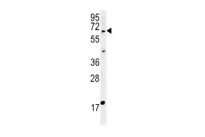 MKRN3 Antibody (Center) (ABIN651835 and ABIN2840417) western blot analysis in MDA-MB435cell line lysates (15 μg/lane). (MKRN3 抗体  (AA 160-189))