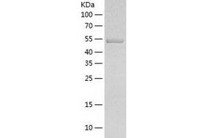 Western Blotting (WB) image for Seryl-tRNA Synthetase (SARS) (AA 1-514) protein (His tag) (ABIN7125066) (Seryl-tRNA Synthetase (SARS) (AA 1-514) protein (His tag))
