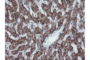 Image no. 9 for anti-SKI-Like Oncogene (SKIL) (AA 307-684) antibody (ABIN1491380)