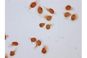 Immunocytochemistry analysis of ABIN7139147 diluted at 1:5 and staining in Hela cells (treated with 30mM sodium butyrate for 4h) performed on a Leica BondTM system. (Histone H2B 抗体  (acLys108))