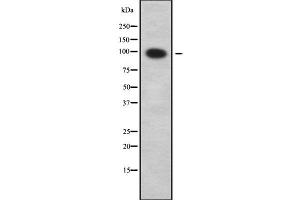 Western blot analysis SLC9A2 using COLO205 whole cell lysates