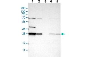 Western blot analysis of Lane 1: RT-4, Lane 2: U-251 MG, Lane 3: Human Plasma, Lane 4: Liver, Lane 5: Tonsil with BPGM polyclonal antibody  at 1:250-1:500 dilution. (BPGM 抗体)