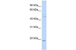 CIB3 antibody used at 1 ug/ml to detect target protein. (CIB3 抗体  (N-Term))