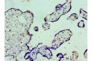 Immunohistochemistry (IHC) image for anti-Vitronectin (VTN) (AA 364-478) antibody (ABIN7175561)