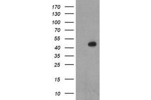 Image no. 1 for anti-LIM Homeobox 1 (LHX1) (AA 100-362) antibody (ABIN1490805) (LHX1 抗体  (AA 100-362))