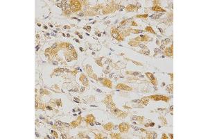 Immunohistochemistry of paraffin-embedded human stomach using OLR1 antibody at dilution of 1:200 (x400 lens). (OLR1 抗体  (AA 58-273))