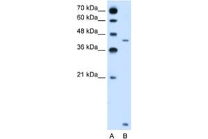 WB Suggested Anti-SLC46A3 Antibody Titration:  2. (SLC46A3 抗体  (N-Term))