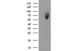 Western Blotting (WB) image for anti-Kelch-Like ECH-Associated Protein 1 (KEAP1) antibody (ABIN1499015) (KEAP1 抗体)