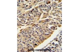 Immunohistochemistry (IHC) image for anti-Cathepsin E (CTSE) antibody (ABIN3002688) (Cathepsin E 抗体)