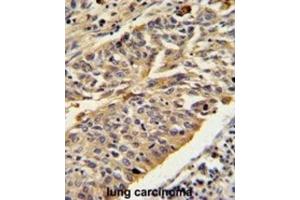 Immunohistochemistry (IHC) image for anti-Cathepsin E (CTSE) antibody (ABIN3002688)
