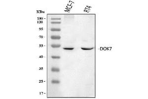 Western blot analysis of DOK7 using anti-DOK7 antibody (ABIN6719428).