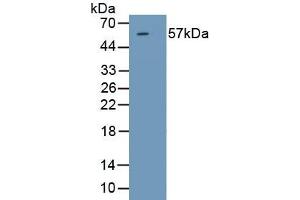 Detection of Recombinant SRD5a1, Rat using Polyclonal Antibody to Steroid 5 Alpha Reductase 1 (SRD5a1) (SRD5A1 抗体)