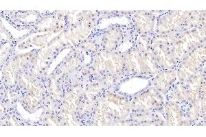 Detection of TGFb3 in Human Kidney Tissue using Polyclonal Antibody to Transforming Growth Factor Beta 3 (TGFb3) (TGFB3 抗体  (AA 274-372))