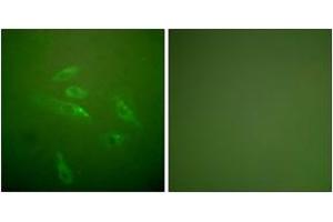 Immunofluorescence (IF) image for anti-Collagen, Type III (COL3) (AA 81-130) antibody (ABIN1533238)