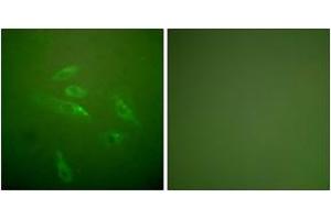 Immunofluorescence analysis of HeLa cells, using Collagen III Antibody. (COL3 抗体  (AA 81-130))