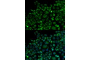 Immunofluorescence analysis of MCF-7 cells using TLR7 antibody. (TLR7 抗体)