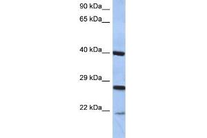 WB Suggested Anti-CIDEB Antibody Titration:  0.