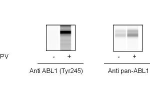 ABL1 ELISA 试剂盒