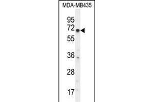 KCNQ1 Antibody (N-term) (ABIN656077 and ABIN2845424) western blot analysis in MDA-M cell line lysates (35 μg/lane). (KCNQ1 抗体  (N-Term))