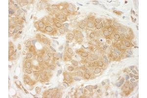 Immunohistochemistry (IHC) image for anti-GIT1 (GIT1) (AA 600-650) antibody (ABIN7454432)
