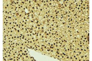 ABIN6277078 at 1/100 staining Mouse liver tissue by IHC-P. (LYN 抗体  (C-Term))