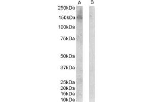Image no. 1 for anti-Receptor Tyrosine-Protein Kinase ErbB-3 (ERBB3) (C-Term), (Isoform 1) antibody (ABIN374599) (ERBB3 抗体  (C-Term, Isoform 1))
