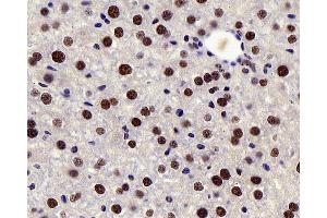 Immunohistochemistry analysis of paraffin-embedded mouse liver using c-Fos Polyclonal Antibody at dilution of 1:200. (c-FOS 抗体)