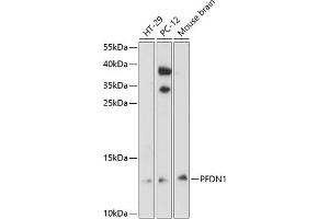Western blot analysis of extracts of various cell lines, using PFDN1 antibody (ABIN6129588, ABIN6145476, ABIN6145477 and ABIN6224751) at 1:3000 dilution. (PFDN1 抗体  (AA 1-122))