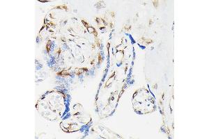 Immunohistochemistry (IHC) image for anti-Vasodilator-Stimulated phosphoprotein (VASP) (pSer239) antibody (ABIN3019749)