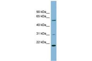 Image no. 1 for anti-TP53RK Binding Protein (TPRKB) (AA 35-84) antibody (ABIN6742046) (TPRKB 抗体  (AA 35-84))