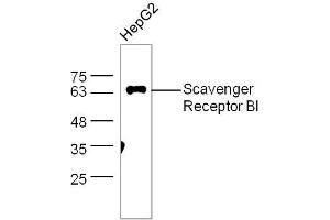 Western Blotting (WB) image for anti-Scavenger Receptor Class B, Member 1 (SCARB1) (AA 21-100) antibody (ABIN738936)