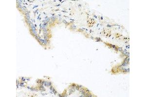 Immunohistochemistry of paraffin-embedded Mouse lung using RETN Polyclonal Antibody at dilution of 1:100 (40x lens). (Resistin 抗体)