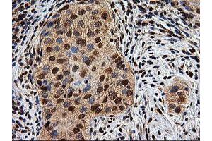 Image no. 7 for anti-EPM2A (Laforin) Interacting Protein 1 (EPM2AIP1) antibody (ABIN1498046) (EPM2AIP1 抗体)