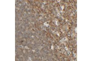 Immunohistochemical analysis of TFCP2L1 in rat colon tissue with TFCP2L1 polyclonal antibody  at 2. (TFCP2L1 抗体  (N-Term))