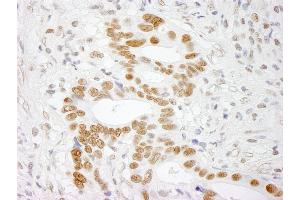 Immunohistochemistry (IHC) image for anti-RNA-binding protein Raly (RALY) (AA 256-306) antibody (ABIN7448753)