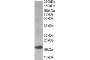 Western Blotting (WB) image for anti-Ubiquitin-Conjugating Enzyme E2I (UBE2I) (N-Term) antibody (ABIN2465320)