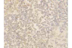 Anti-Cullin 4B antibody, IHC(P) IHC(P): Zebrafish Body Tissue
