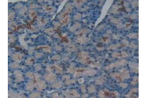 IHC-P analysis of Rat Pancreas Tissue, with DAB staining. (TNFRSF11A 抗体  (AA 31-214))