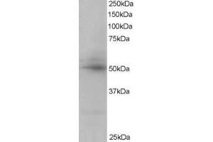 Western Blotting (WB) image for anti-CAMP Responsive Element Binding Protein 3-Like 4 (CREB3L4) (C-Term) antibody (ABIN2465555) (CREB3L4 抗体  (C-Term))