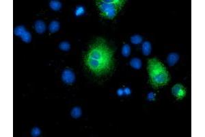 Anti-TMEM80 mouse monoclonal antibody (ABIN2453727) immunofluorescent staining of COS7 cells transiently transfected by pCMV6-ENTRY TMEM80 (RC202288). (TMEM80 抗体)