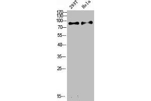 Western Blot analysis of various cells using Antibody diluted at 1:1000. (IL4 Receptor 抗体  (Internal Region))