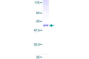 PPM1B Protein (AA 1-192) (GST tag)