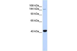 WB Suggested Anti-JAK3 Antibody Titration: 0. (JAK3 抗体  (Middle Region))
