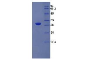 SDS-PAGE analysis of Rat Elastase 3B Protein. (Elastase 3B 蛋白)