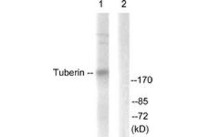 Western blot analysis of extracts from 293 cells, treated with Anisomycin 25ug/ml 30', using Tuberin/TSC2 (Ab-939) Antibody. (Tuberin 抗体  (AA 905-954))