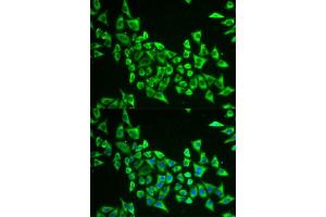 Immunofluorescence analysis of U2OS cells using MRPS30 antibody. (MRPS30 抗体  (AA 190-439))