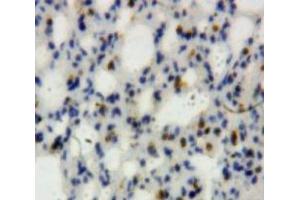 Used in DAB staining on fromalin fixed paraffin-embedded Lung tissue (Lipocalin 2 抗体  (AA 21-200))