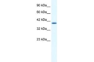 WB Suggested Antibody  Titration: 0. (ZNF365 抗体  (N-Term))