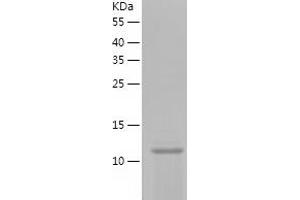 Ionized Calcium-binding Adapter Molecule 1 (IBA1) (AA 2-147) protein (His-IF2DI Tag)
